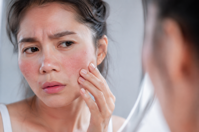 skin barrier