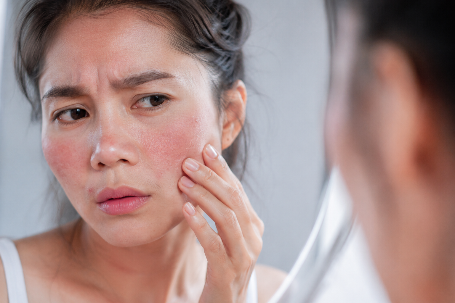 skin barrier
